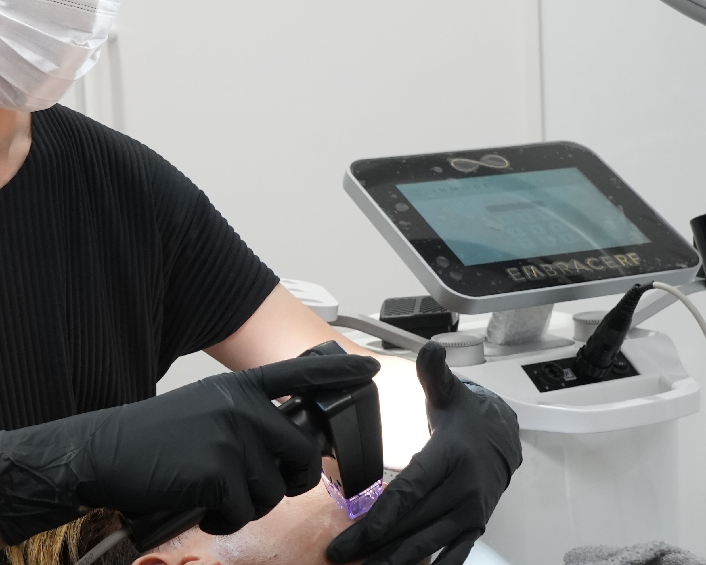 Morpheus8 RF Microneedling for Skin Tightening and Rejuvenation at BIANCA Clinic in Tokyo, Japan